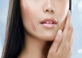 Thuốc trị sẹo lồi có tác dụng thế nào và những lưu ý khi chọn thuốc?