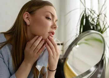 5 điều cần tránh khi trị mụn ở cằm