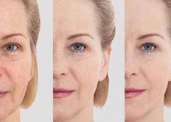 6 yếu tố khiến collagen trong da bị suy giảm gây lão hóa