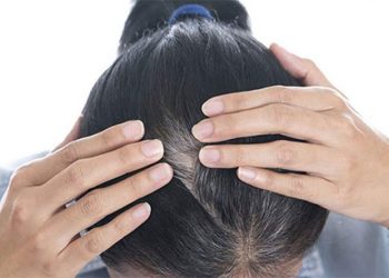 Ngăn chặn tóc bạc sớm với 4 việc đơn giản
