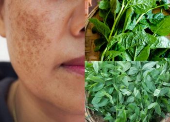 Trị nám da hiệu quả bằng rau ngót, mồng tơi
