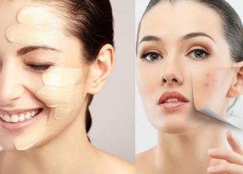 Những lưu ý cần biết khi trang điểm cho da mụn