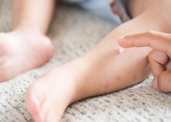 Thuốc trị ghẻ ngứa bôi ngoài da và hướng dẫn cách sử dụng