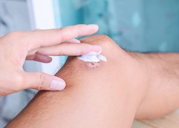 Thuốc liền sẹo: phân loại, nguyên tắc lựa chọn và các loại thường dùng