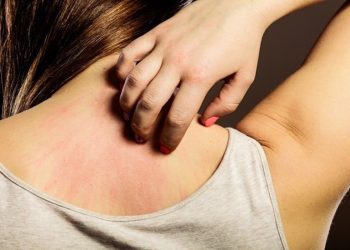 Các bài thuốc trị ngứa ngoài da hiệu quả trong dân gian