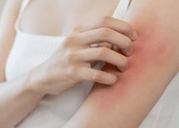 Thuốc ngứa da – Dùng thế nào cho đúng cách?